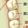 如何清潔智齒和大牙（大臼齒）？學會這一招能省幾萬塊