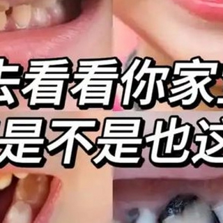 口腔健康干货|这些小知识越早知道越好! —— 小鹿妈妈牙线