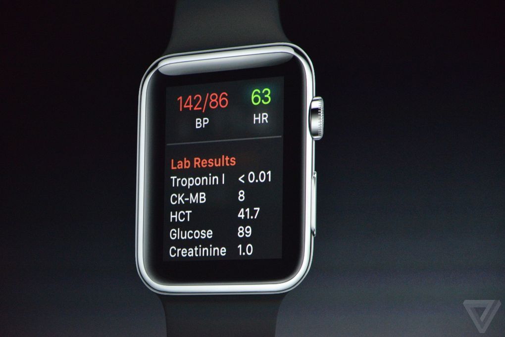 深耕医疗健康：谈谈苹果发布会上的Apple Watch