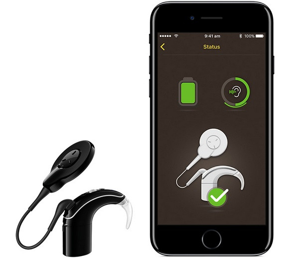 无缝连接Apple设备：Cochlear 科利耳 联合 苹果 开发 Nucleus 7 人工耳蜗