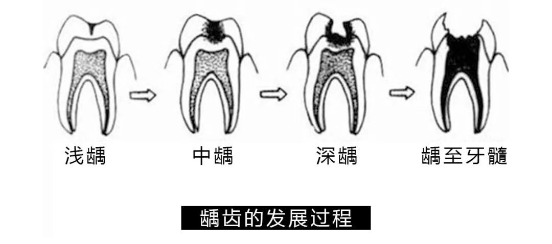 连续喝一个月可乐会有什么后果？