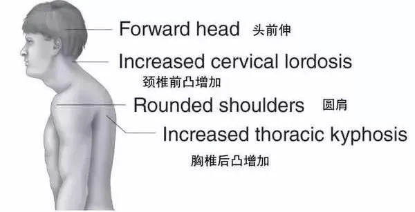 只练卧推不可取，全面增肌才有好身材