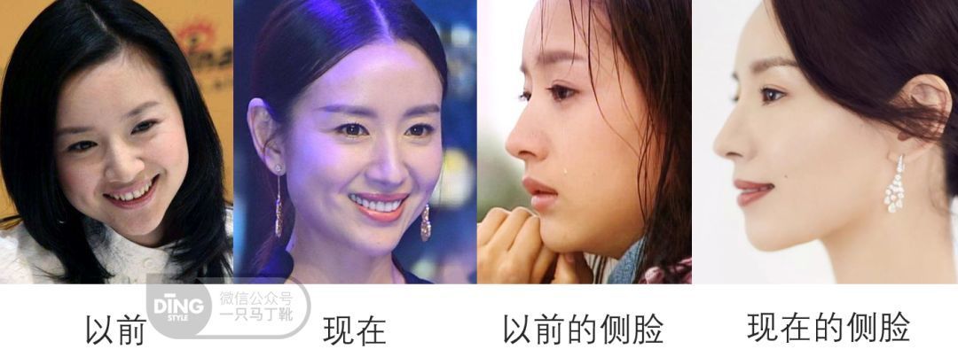 聊颜值硬伤？不如从这个90%大美人都不会有的特征说起