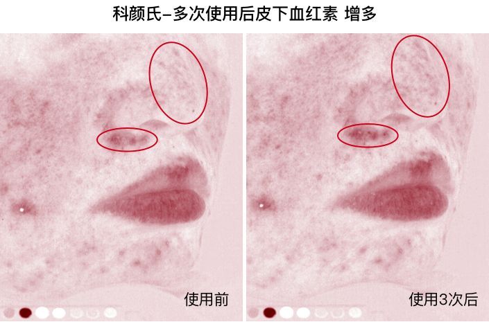 能去黑头还不伤肤，280元的科颜氏白泥面膜竟然败给了15块钱的它