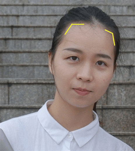 额头高+太阳穴凹陷+颧骨突出...发型是不是没得选了?| 读者分析
