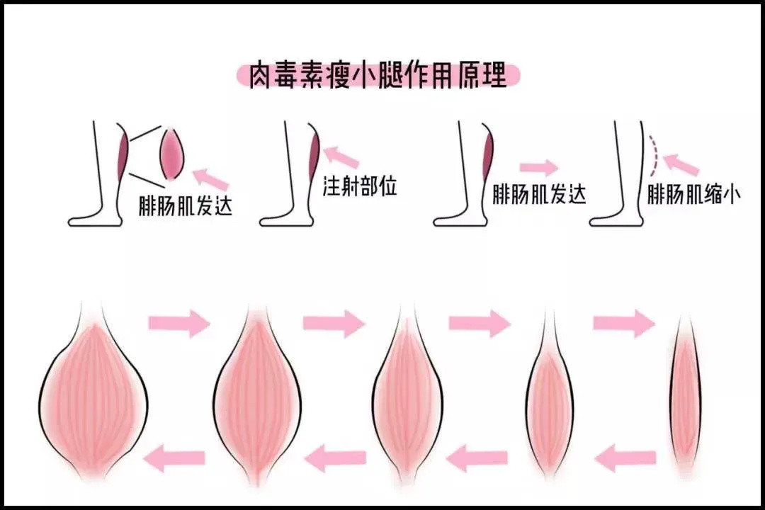 瘦腿教程篇：姐姐的腿不是腿，塞纳河畔的春水