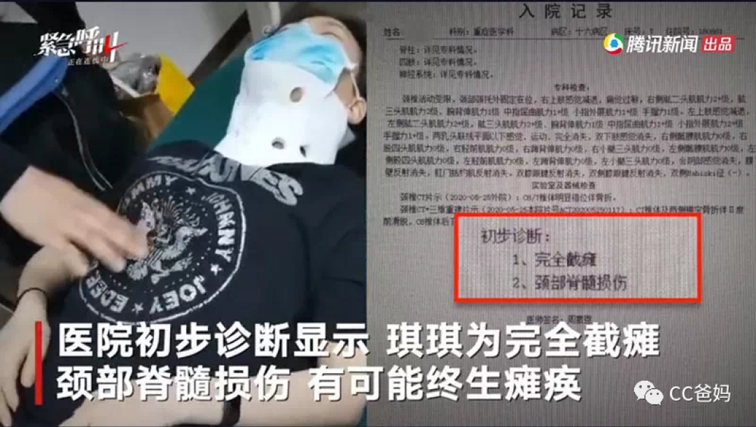 女研究生玩蹦床摔成瘫痪，从来没有人告诉你，这游戏有多危险！