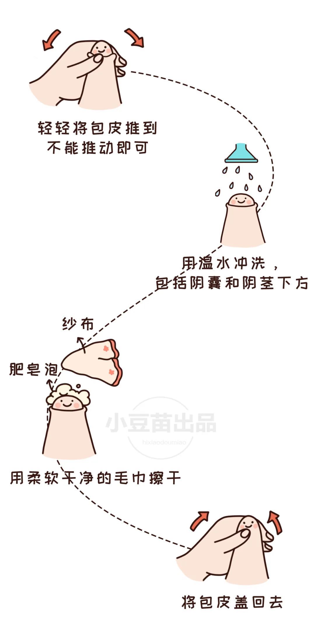 宝宝包皮要不要割？这3种情况爸妈需正视  附清洗以及护理方法