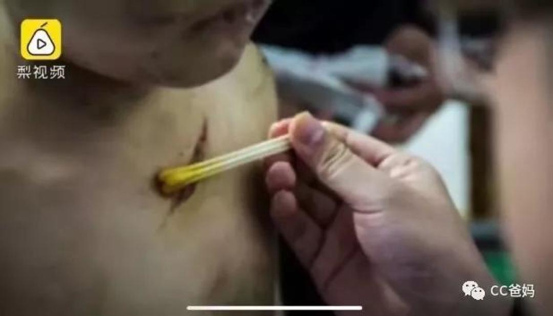 #7岁孩子遭亲妈虐打2年#,打骂孩子会上瘾,看完原因发现自己也中招了……