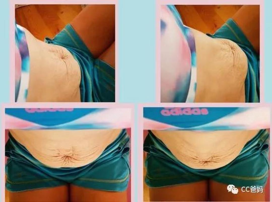 小肚腩去不掉的原因原来是这个,怪不得减肥健身都没用!