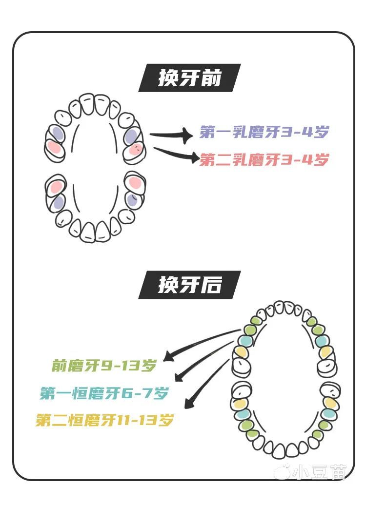 4岁孩子蛀牙竟要摘掉一只眼！关于乳牙护理爸爸妈妈要知道的7个真相