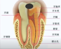 牙缝发黑千万不要心大，说不准就是藏匿的蛀牙（内附判断方法）