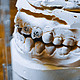 好惨一口牙：补牙、根管、修复、拔牙、洗牙，聊聊我的牙科经历