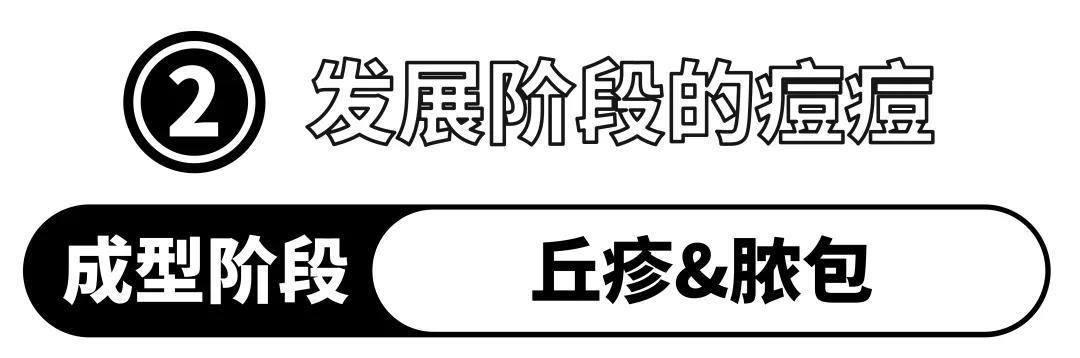 ICU警告 | 你挤痘的样子,像是在玩命!