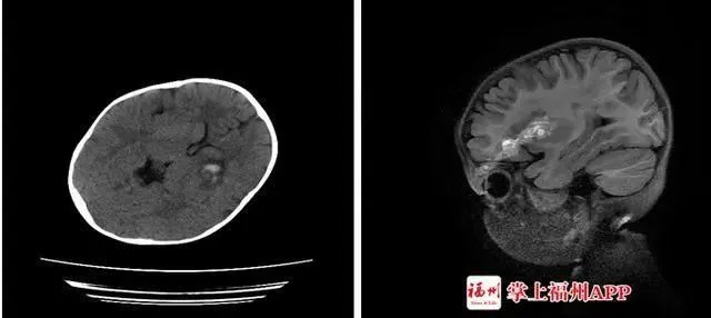 戳进眼睛，直插颅脑…网红夺命儿童玩具又来了！你家有孩子在玩吗？