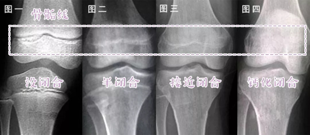 如何科学地增高？孩子身高的计算方法以及成长规律（18岁以上同样适用）