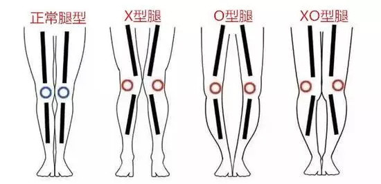 如何科学地增高？孩子身高的计算方法以及成长规律（18岁以上同样适用）