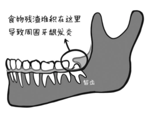 阅读牙科万字文，牙医从此请回家，学学如何运用科学思维来看牙！