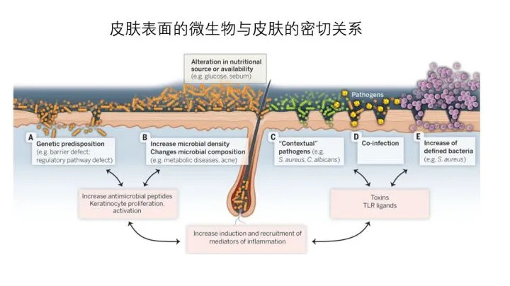 世界性难题——痘痘，不仅仅属于护肤范畴，更是一种皮肤疾病～