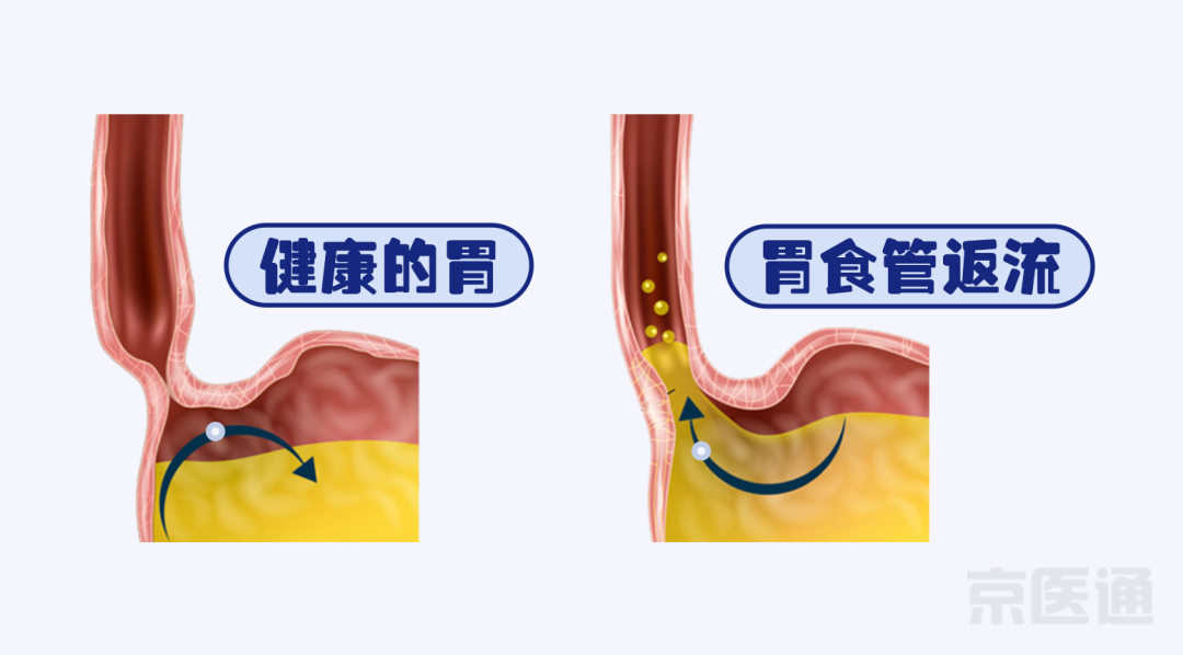 胃疼确诊肝癌？腿疼差点猝死？警惕误导我们的这些症状~