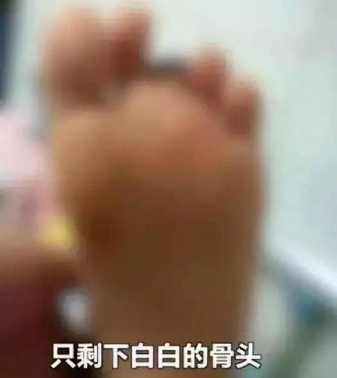 妈妈抱着一岁半宝宝滑滑梯,突然“啪”的一声孩子腿断了,这些危险你想像不到