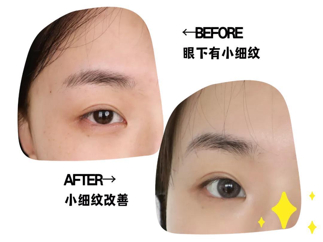每天一个“显年轻”小知识,不得不知道~