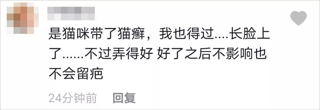 女孩疯狂吸猫不到十天头秃了！网友：太像河童了…