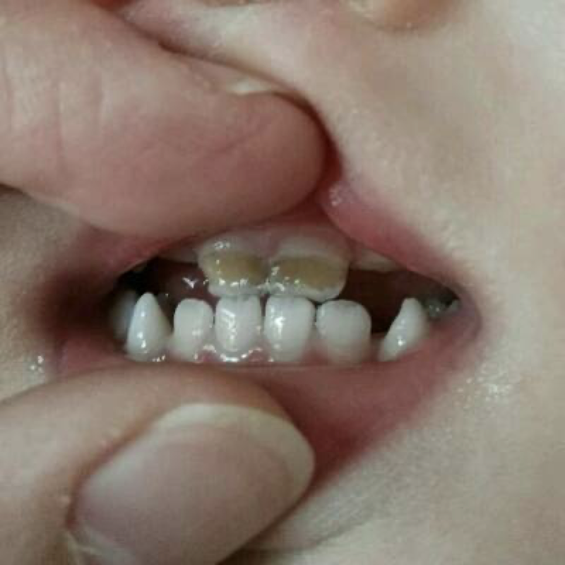 大部分人不知道的牙科常识！618为你的口腔健康囤货！