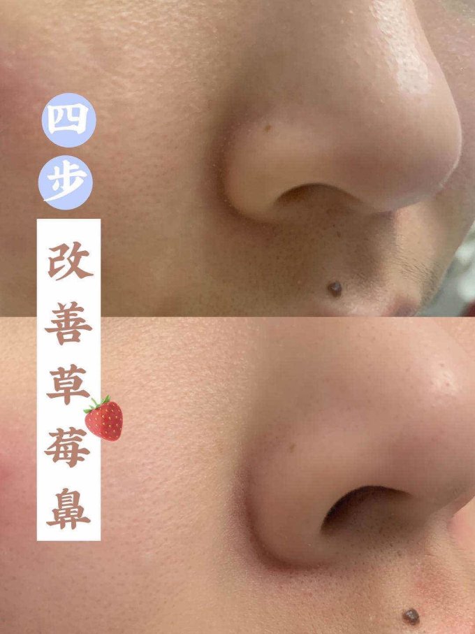 博思迪美容器