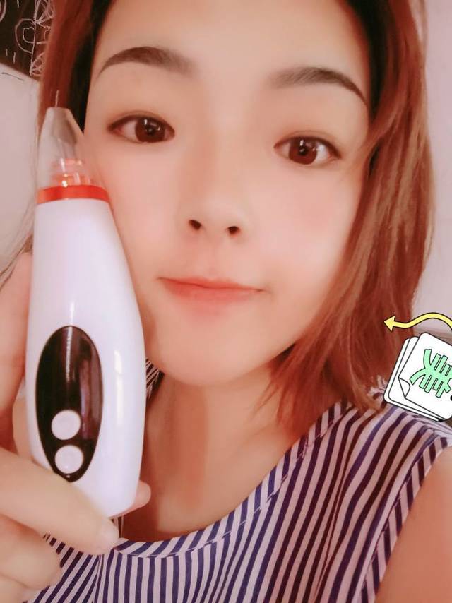 微晶黑头仪