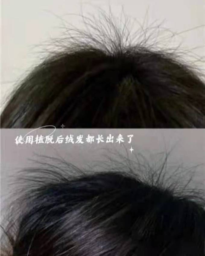 植脱洗发水