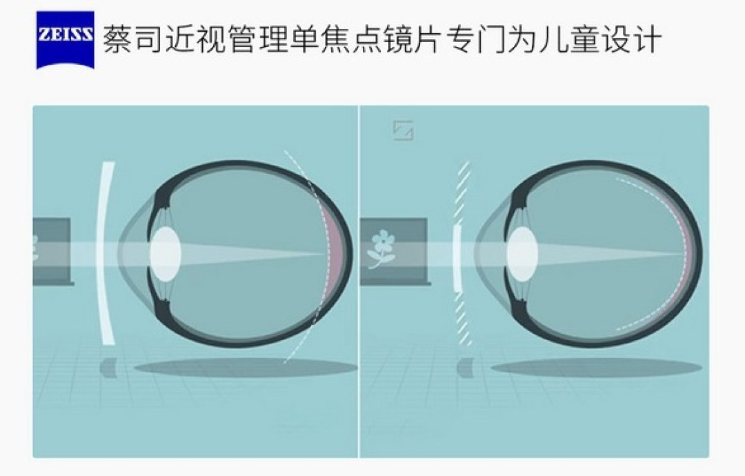 眼镜派 | 蔡司众多系列产品,究竟哪款值得买?这8款镜片比「新清锐 1.74 超薄」更适合你