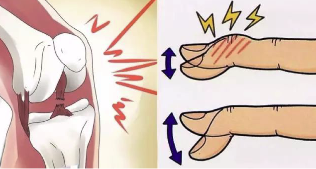 健身时关节“咔咔”响,还可以继续训练吗?
