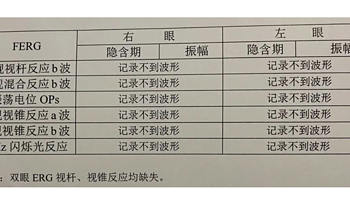 不管睁眼还是闭眼，我的眼前仿佛永远覆盖着彩色效果的电视机雪花