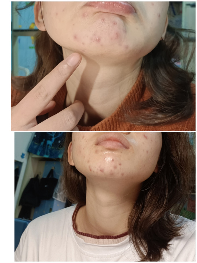 三月理护肤套装