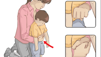 超全汇总10种儿童急救方法：窒息、惊厥、溺水、流鼻血...每个家长都应掌握！