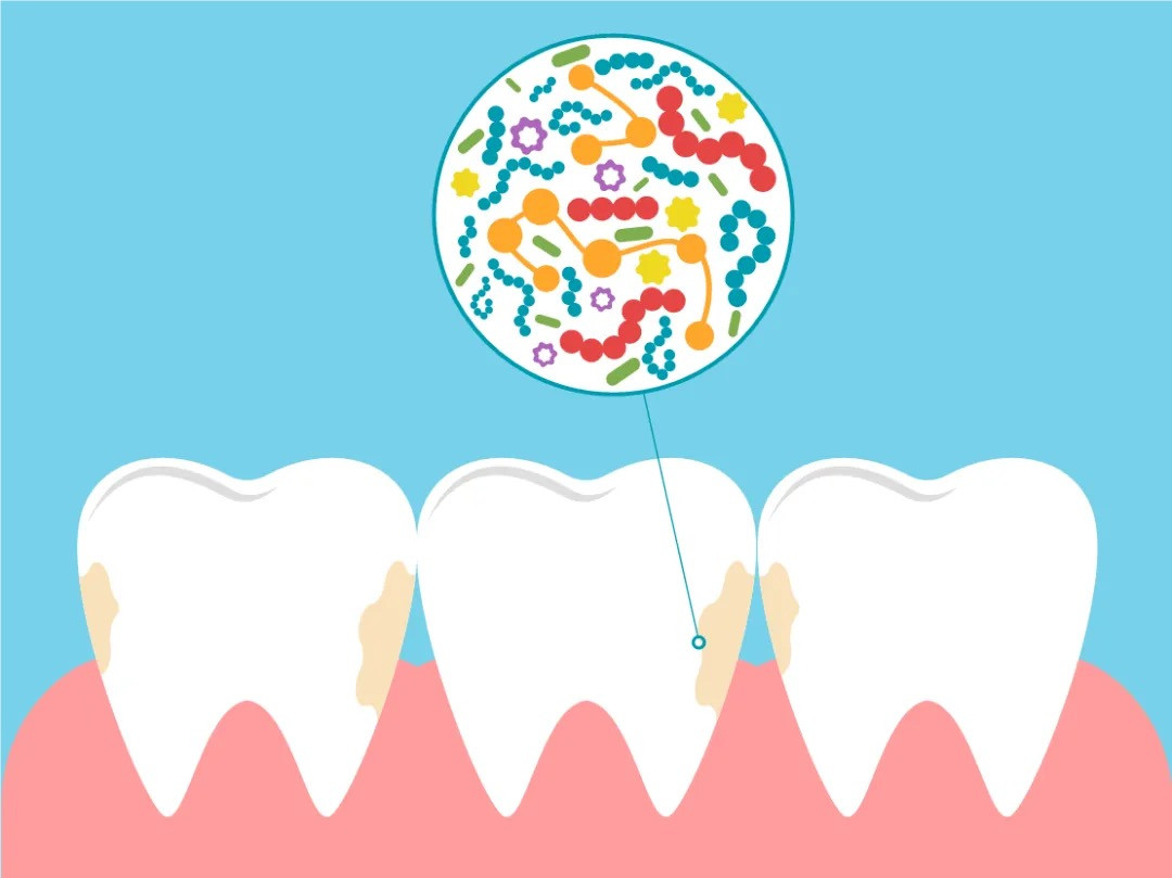 口臭、牙黄、牙齿敏感？这嘴里的事儿真不少！这篇口腔护理干货帮你一波搞定！