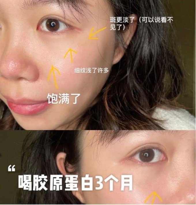 内廷上用骨骼健康