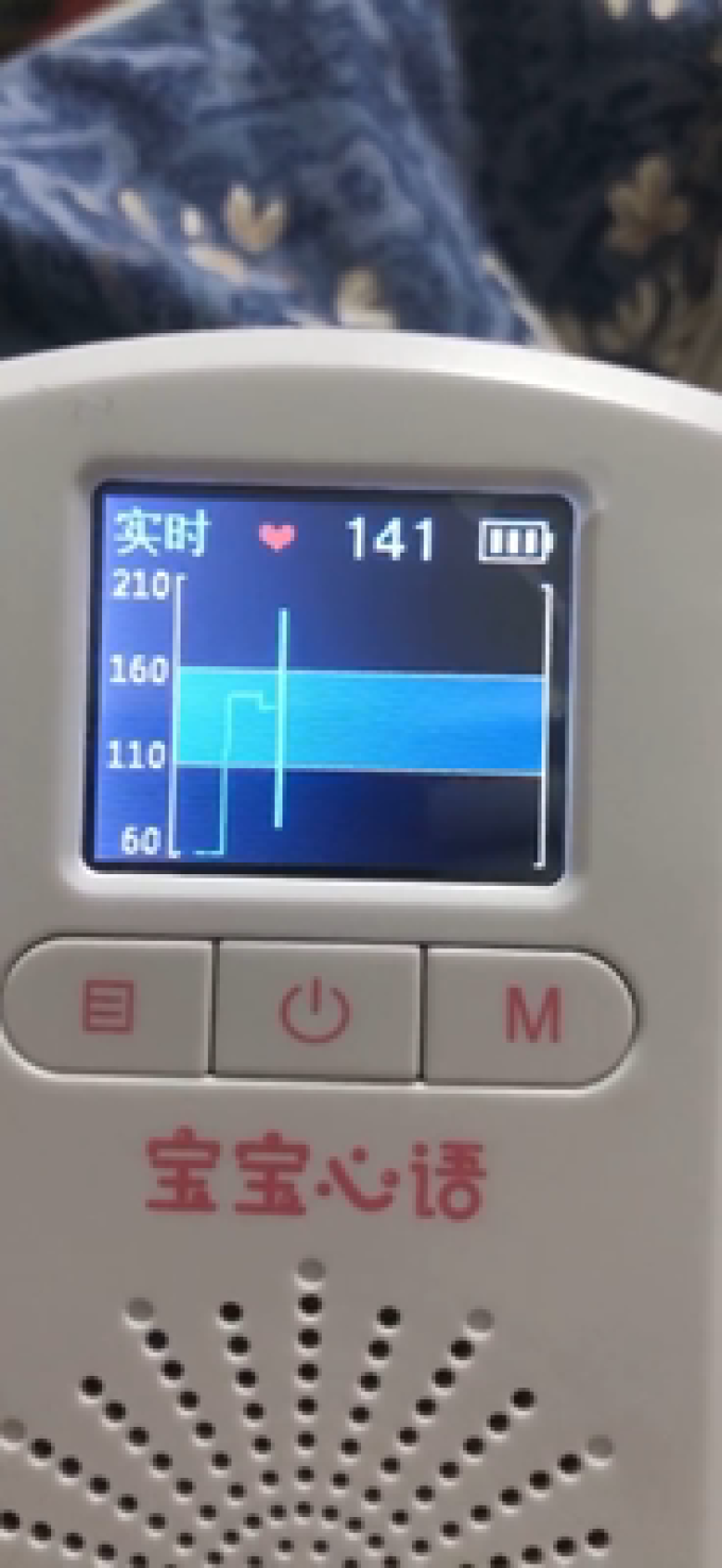 胎心仪