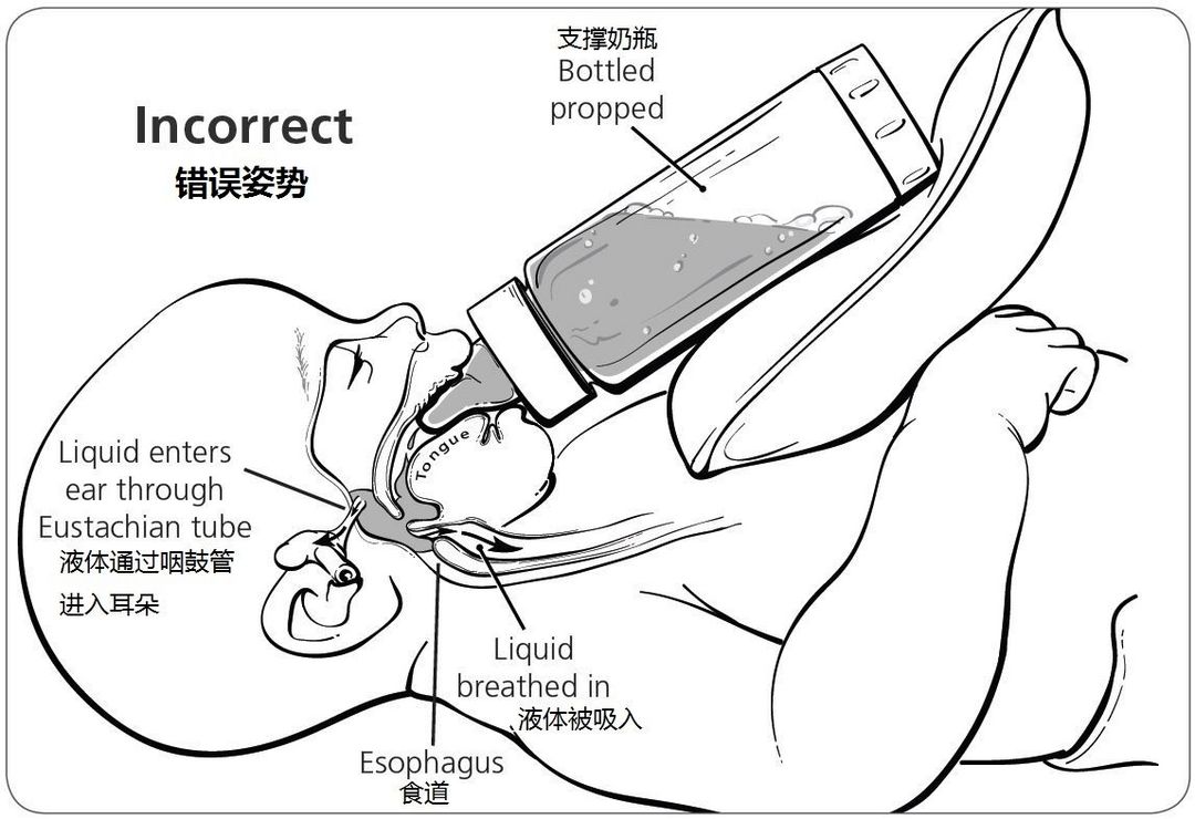 乳牙龋齿危害大，防龋从0～3岁做起，婴幼儿口腔护理深度科普