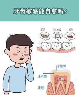 牙齿敏感的因素二