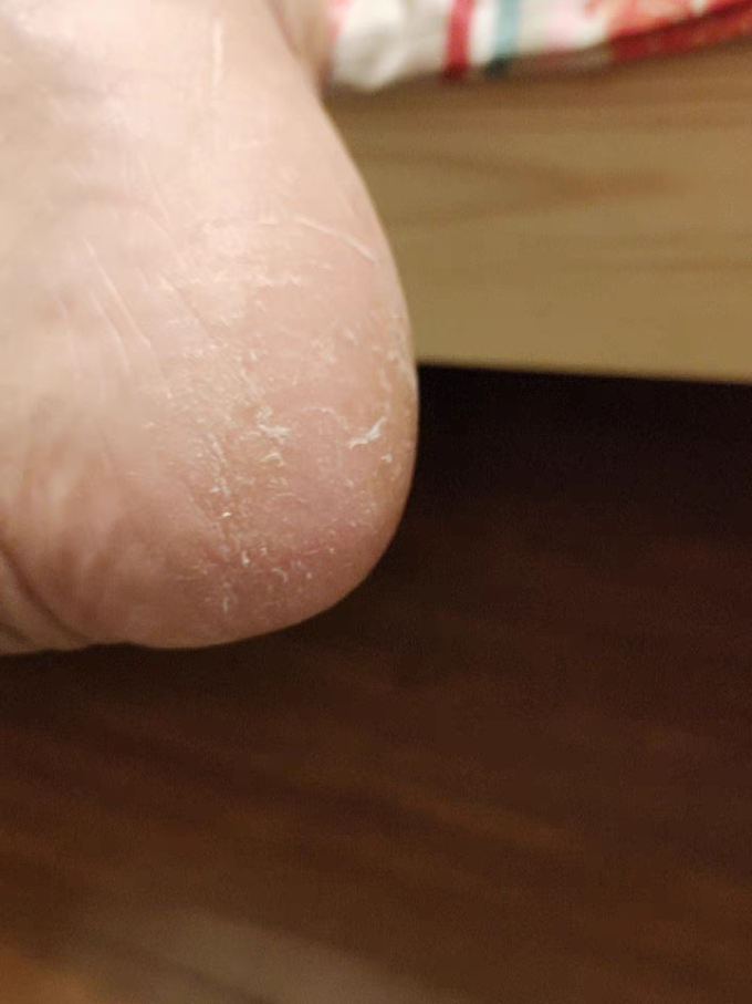 泽亿康手足护理