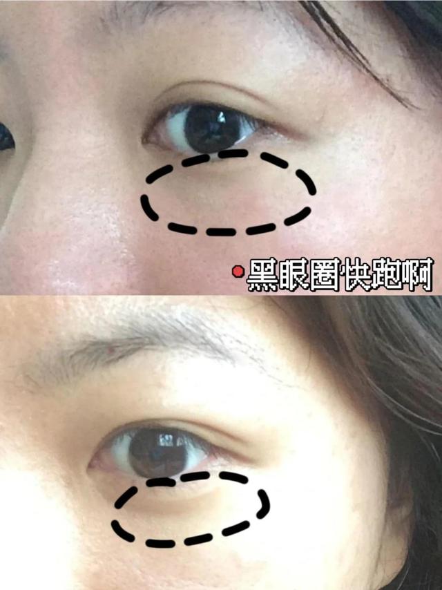 用过最特别的眼膜分享~