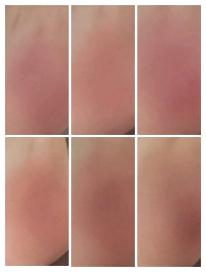 腮红