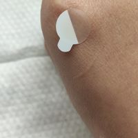 痘痘贴是过气了吗，感觉还挺好用的