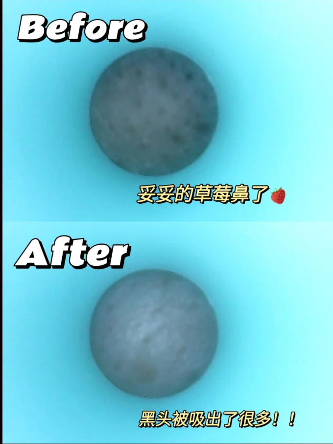 将小将T区护理