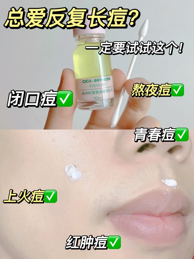 烦人的包包终于不见啦💃好开森