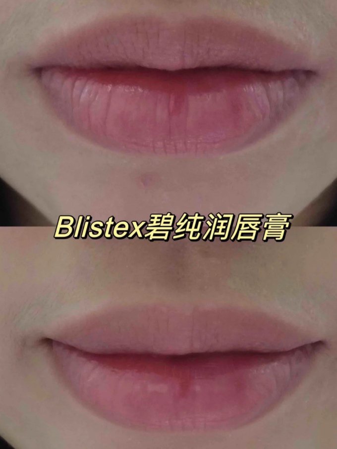 百蕾适润唇膏