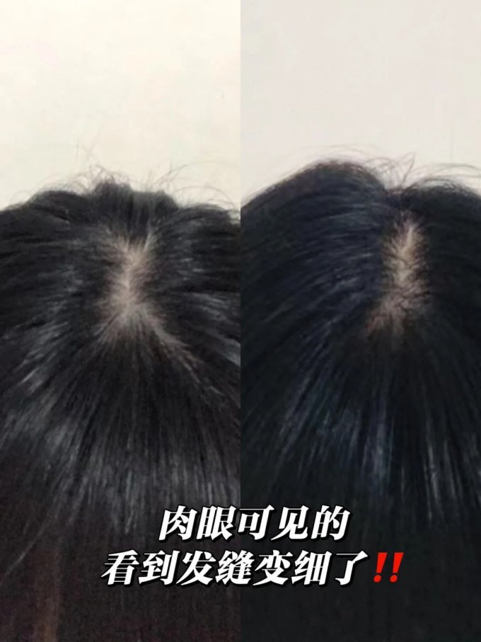 培健固发育发