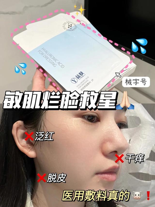 敏肌天菜！痘肌敏皮快试试！